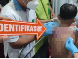 Polres Sukabumi Kota Bekuk Pelaku Penyiraman Air Keras