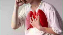 Dinkes Cimahi Pastikan Kasus ISPA Terkendali, Warga Tetap Diminta Waspada